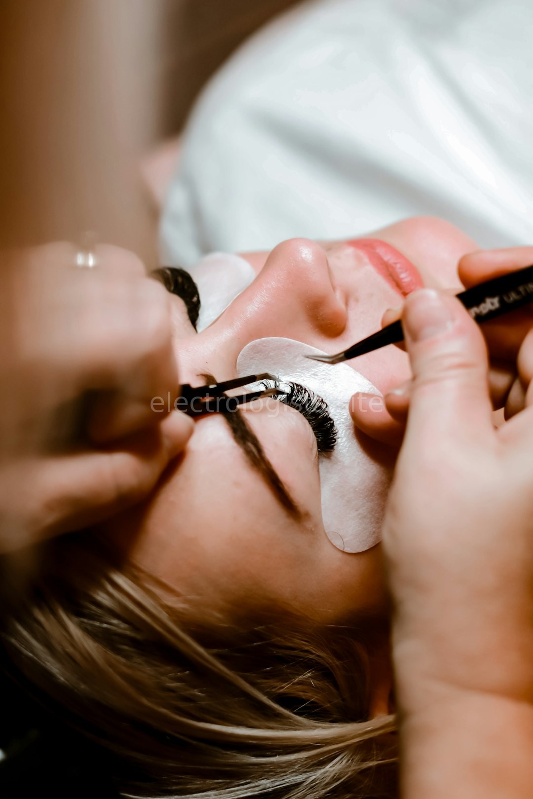 Chemical Peels